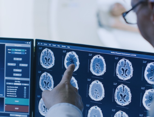 Brain Scans Brain Scans