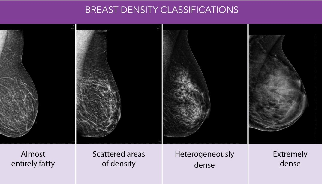 Breast Density Classifications: Almost entirely fatty, Scattered areas of density, Heterogeneously dense, Extremely dense